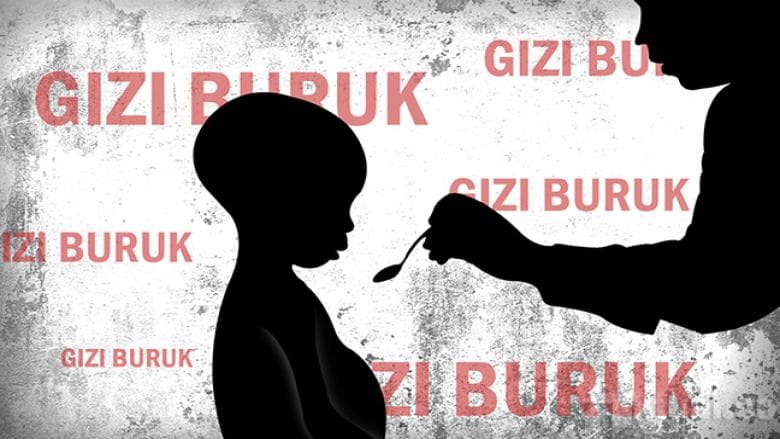 59 Anak di Aceh Utara Menderita Gizi Buruk, Meurah Mulia Terkena Terbanyak