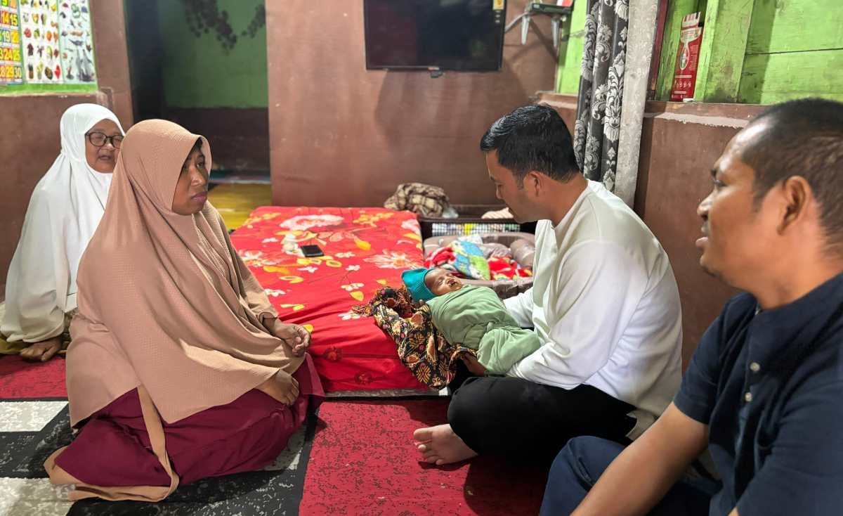 Bupati Aceh Tengah Janjikan Operasi Bibir Sumbing untuk Bayi di Takengon