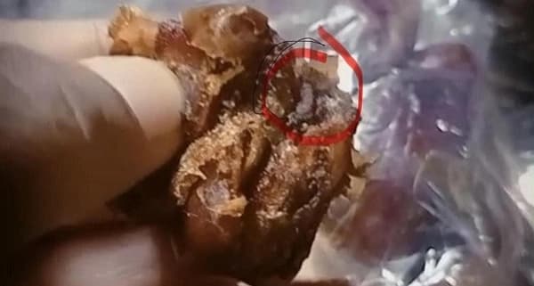 Wali Murid Aceh Jaya Temukan Ulat dalam Menu MBG, Tuntut Penjelasan