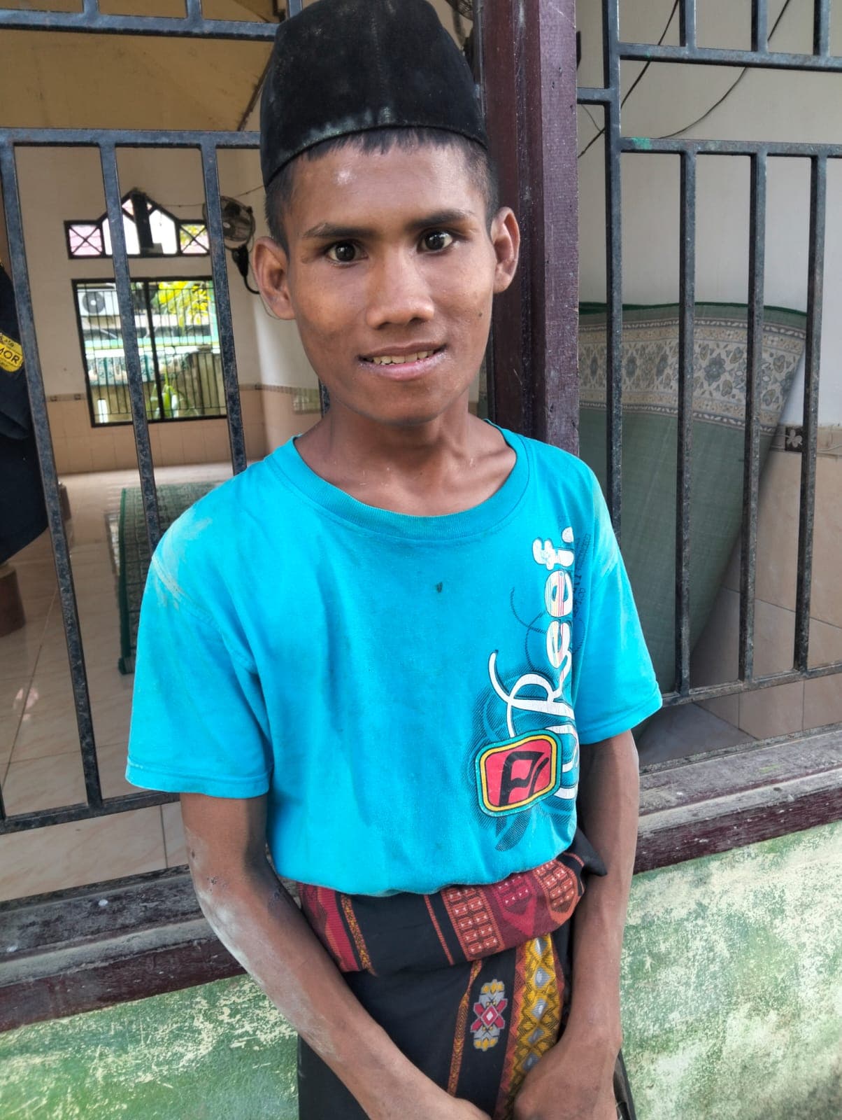 Farhan, 17 Tahun, Luka Seumur Hidup di Tubuh Seorang Anak di Aceh