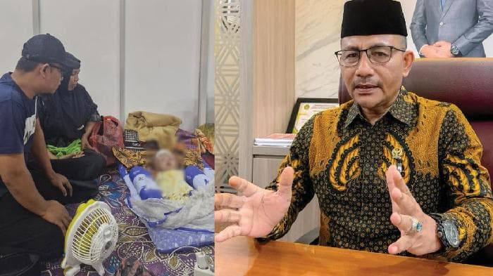 Bayi Hidrosefalus Bireuen Dibantu Haji Uma untuk Operasi di RSUDZA