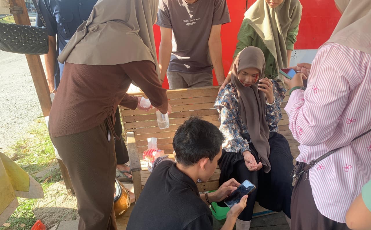 Jalan Berlubang di Lamyong Picu Kecelakaan Beruntun, Warga Aceh Trauma